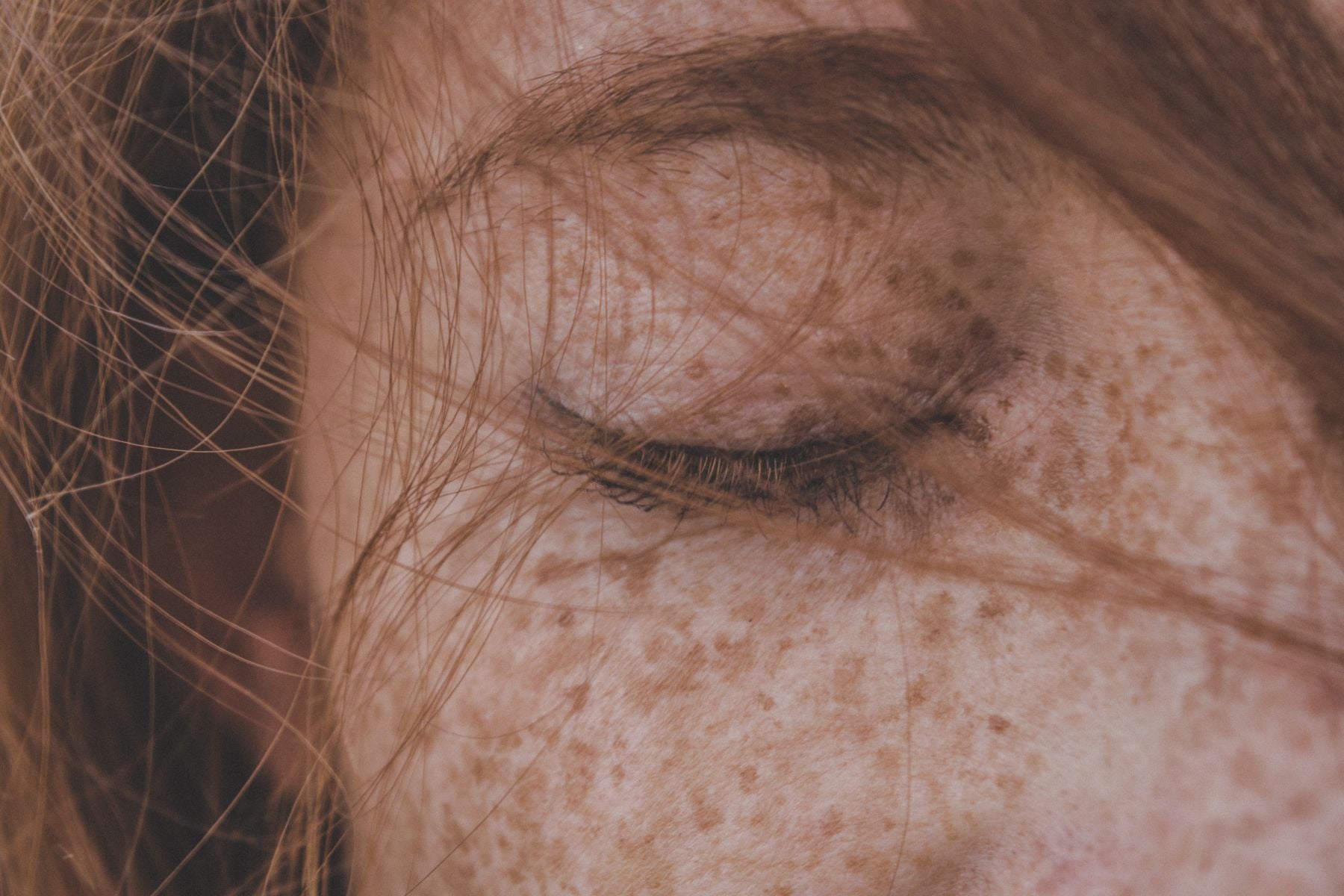 freckled_skin.jpg